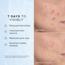 Niacinamide Peptides